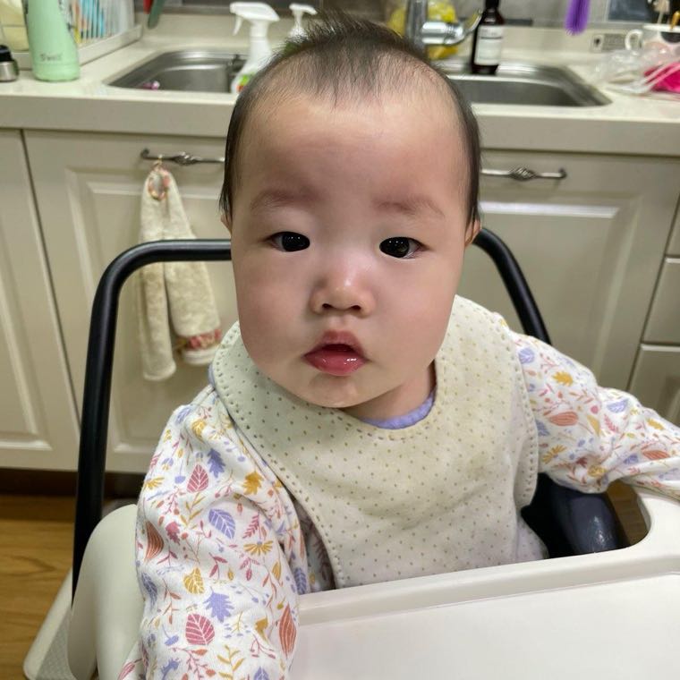 離乳食のアレルギー疑い症状、どんなものが危険信号でしょうか？