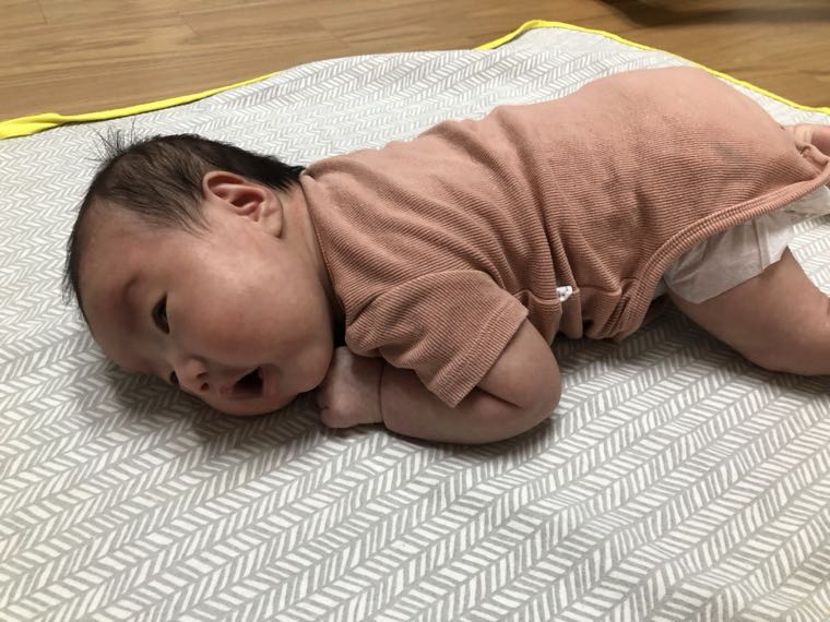 신생아 두상 비대칭 자가진단 | 월령별 정상 범위와 병원 가야 할 신호